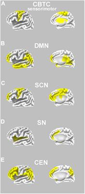 Psychedelics in developmental stuttering to modulate brain functioning: a new therapeutic perspective?